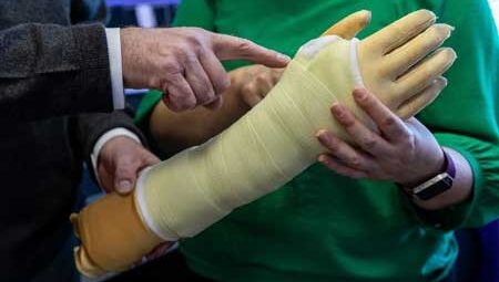 Arm in cast