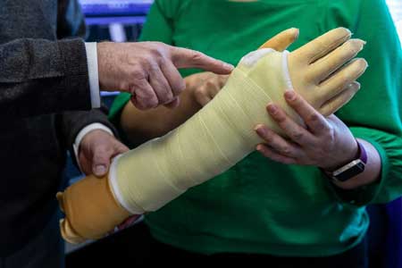 Arm in cast