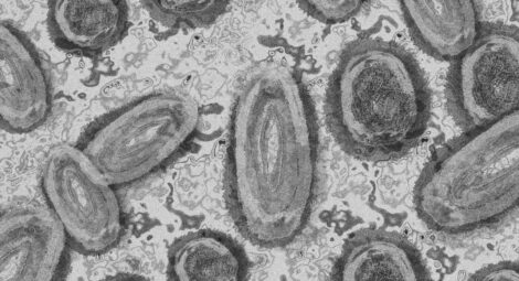 Microscope view of Monkey Pox virus