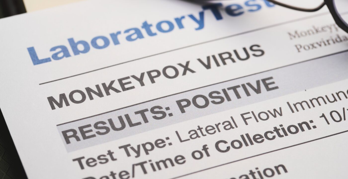 Close up of a monkeypox document
