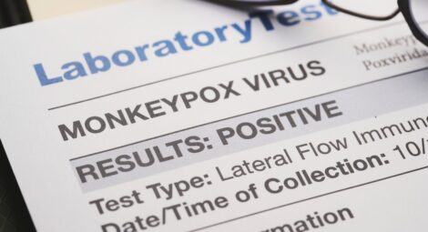 Close up of a monkeypox document