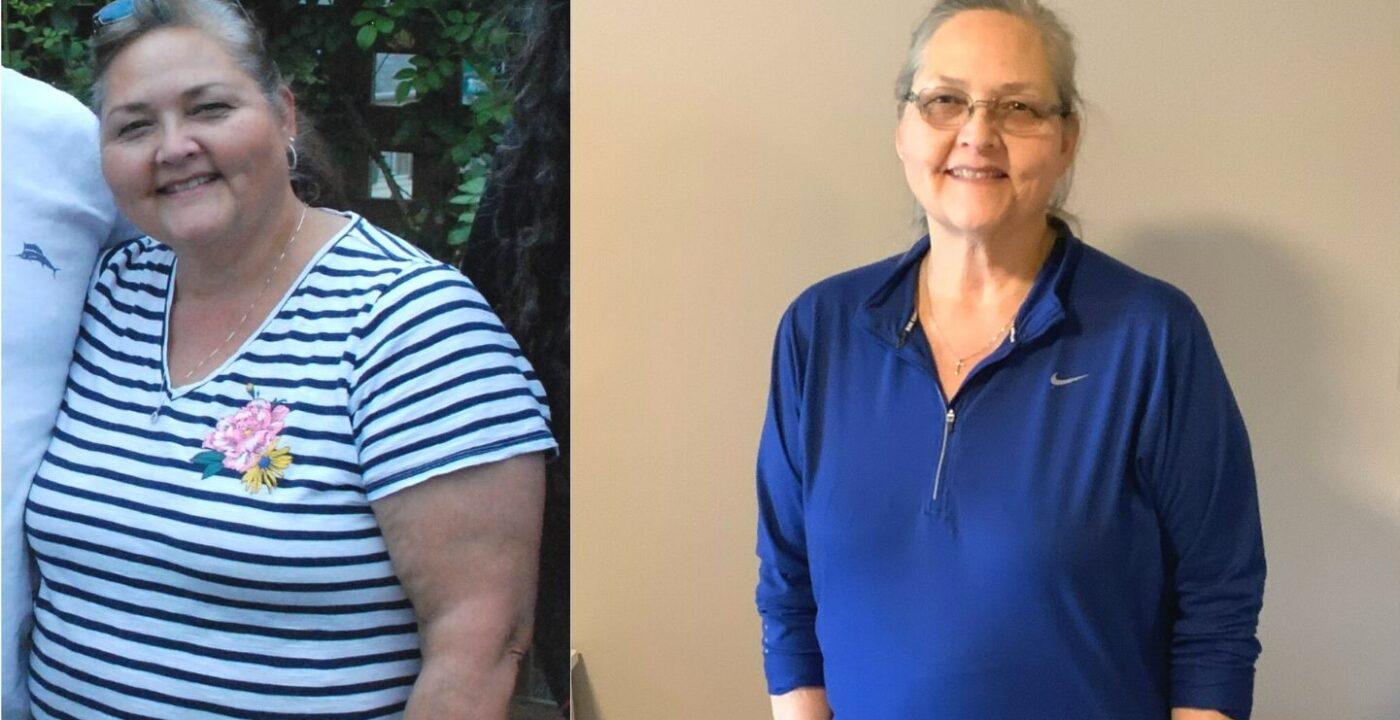 Woman before and after 80-pound weight loss