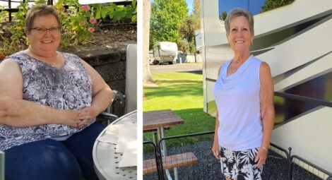 Woman before and after weight-loss surgery