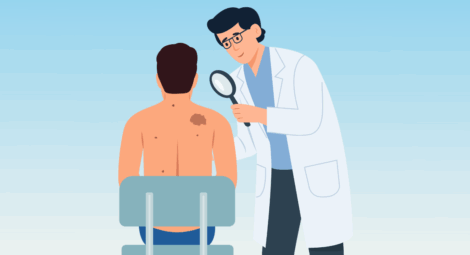 Doctor inspects moles on a patient’s back with a magnifying glass