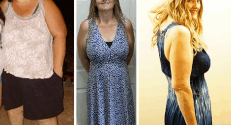 Woman showing three pictures of weight loss progress.