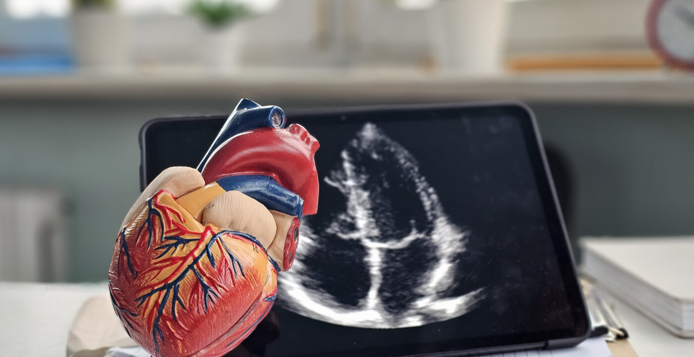 Model of a heart with an echocardiogram displayed on a tablet