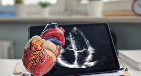 Model of a heart with an echocardiogram displayed on a tablet