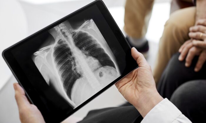 MultiCare pulmonary care