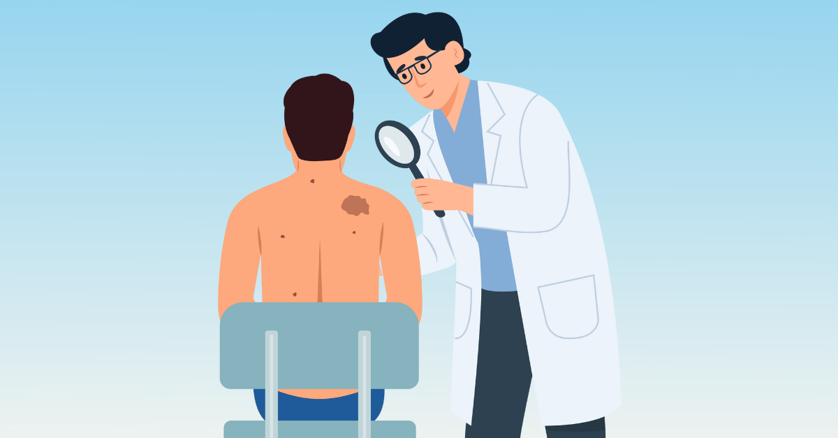 Doctor inspects moles on a patient’s back with a magnifying glass