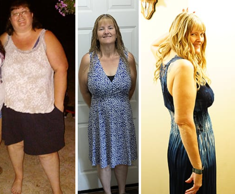 Woman showing three pictures of weight loss progress.